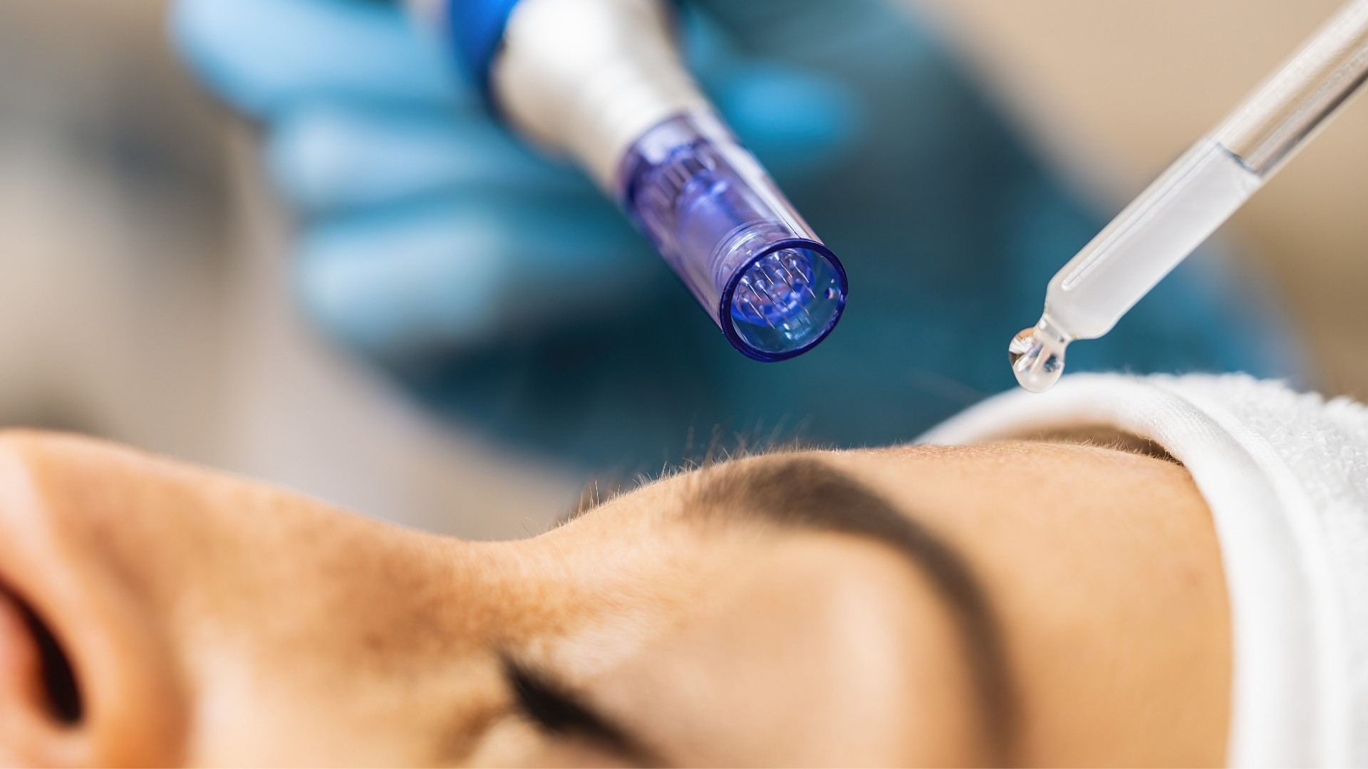 Hyaluronsäure Filler Plastischechirurgie