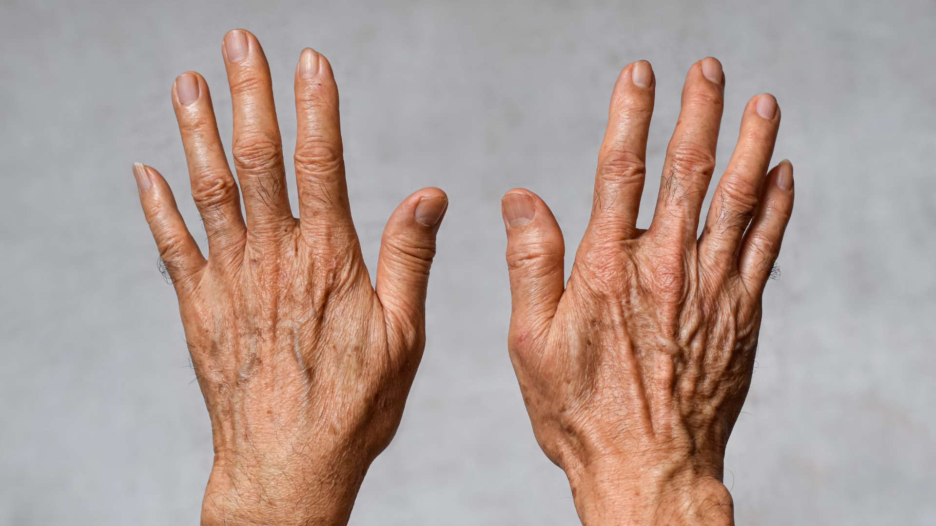 Lipofuscin Altersflecken Autophagie